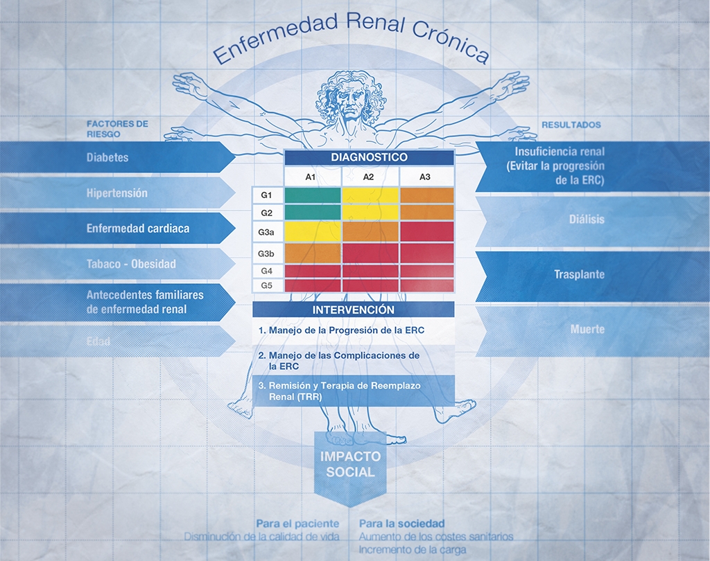La enfermedad renal crónica, la epidemia silenciosa: un desafío social
